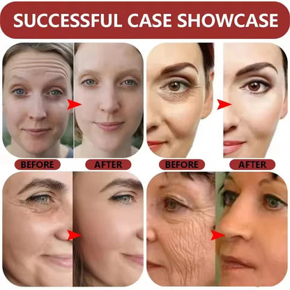 Hyaluronic Acid Anti-Aging Serum Lifting Brightening Dispelling Face Deep Moisturizing Dark Spots Nourishing Improve Elasticity