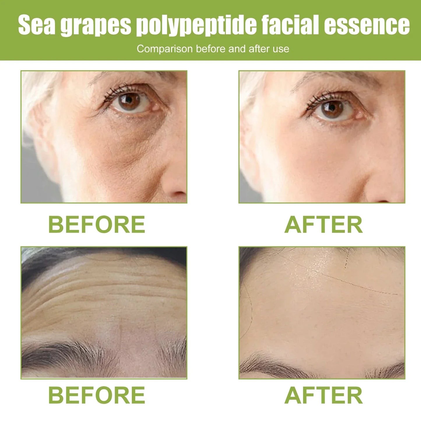 Hyaluronic Acid Anti-Aging Serum Lifting Brightening Dispelling Face Deep Moisturizing Dark Spots Nourishing Improve Elasticity