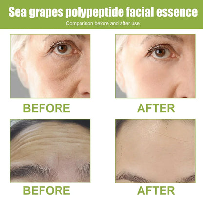 Hyaluronic Acid Anti-Aging Serum Lifting Brightening Dispelling Face Deep Moisturizing Dark Spots Nourishing Improve Elasticity