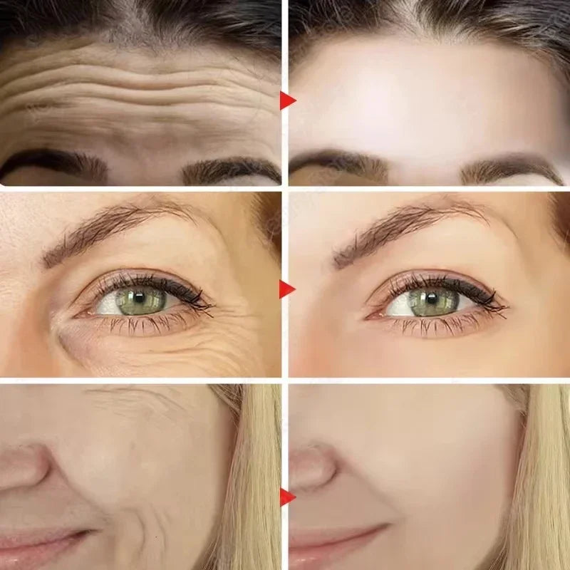 Hyaluronic Acid Anti-Aging Serum Lifting Brightening Dispelling Face Deep Moisturizing Dark Spots Nourishing Improve Elasticity